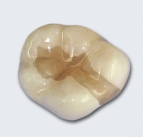 Füllungen kunststofffuellung12.jpg