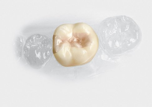 Füllungen bild14ae.jpg